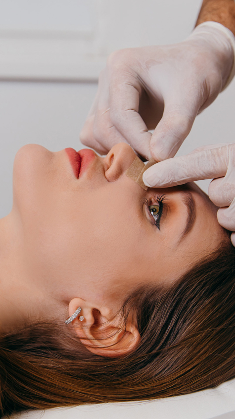 Operacja plastyczna nosa