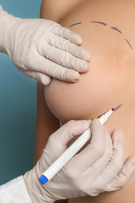 Powiększanie piersi